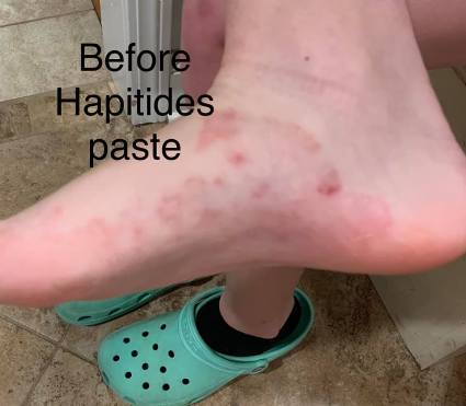 amplifei hapitides results