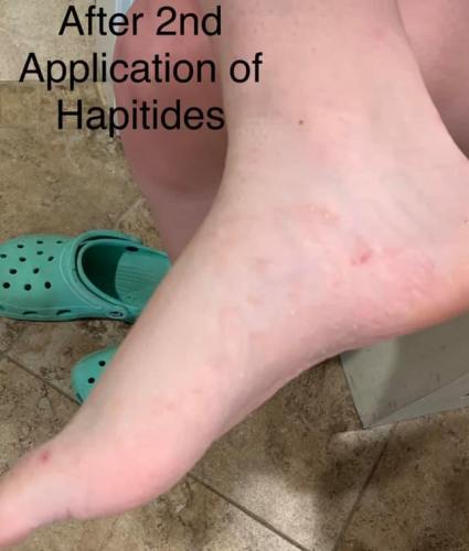 amplifei hapitides results